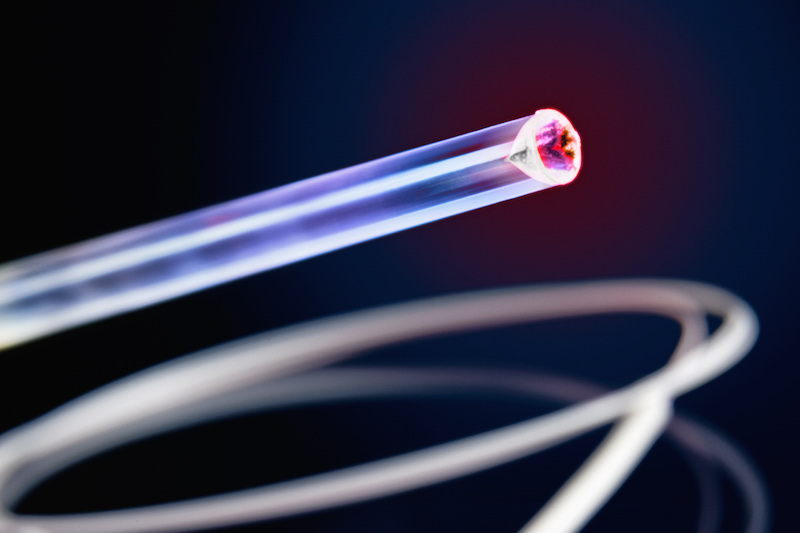 Laserstrukturierte Glasfaserspitze vom Typ Radial Fire für die minimal-invasive Lasermedizin