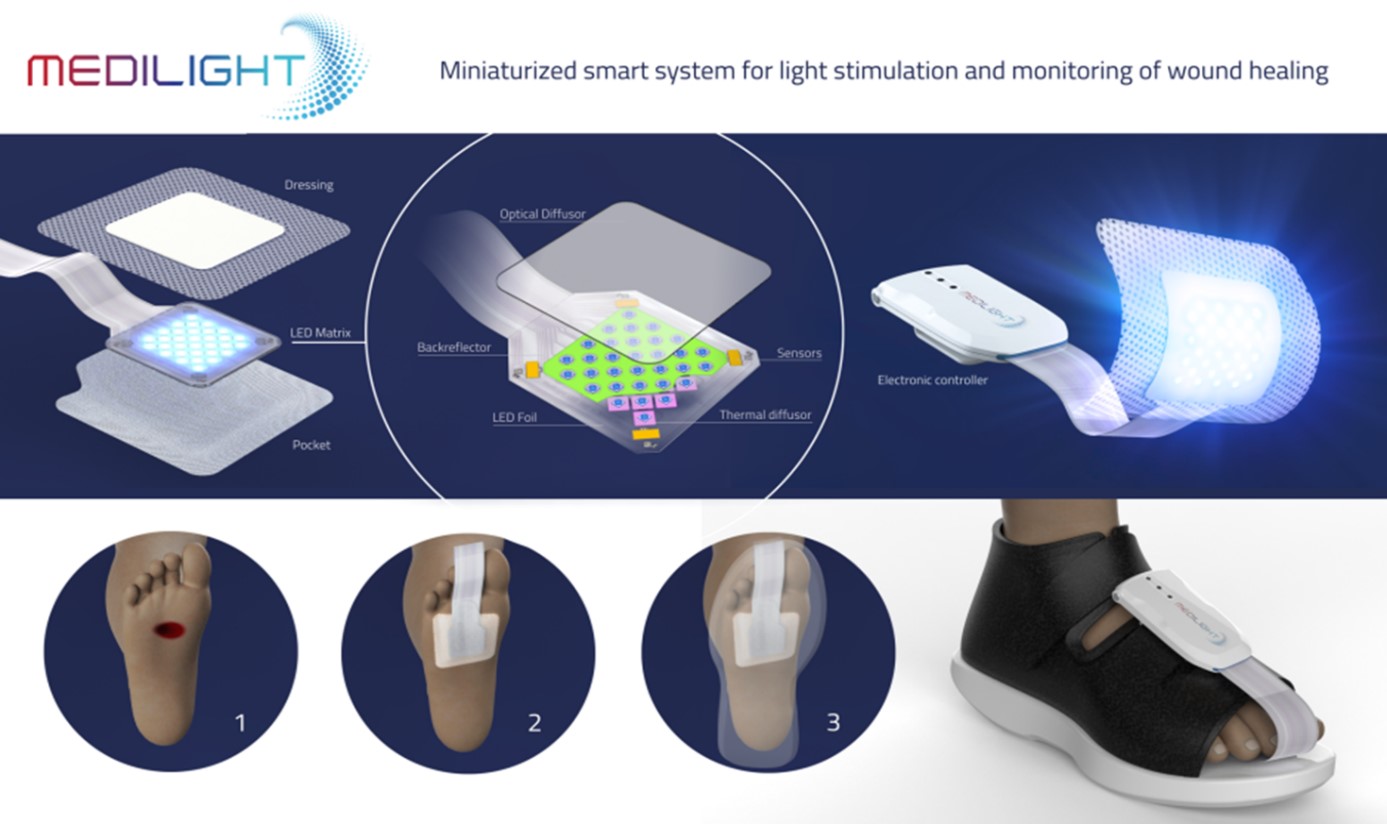 Project Medilight | Miniaturized smart system for wound therapy