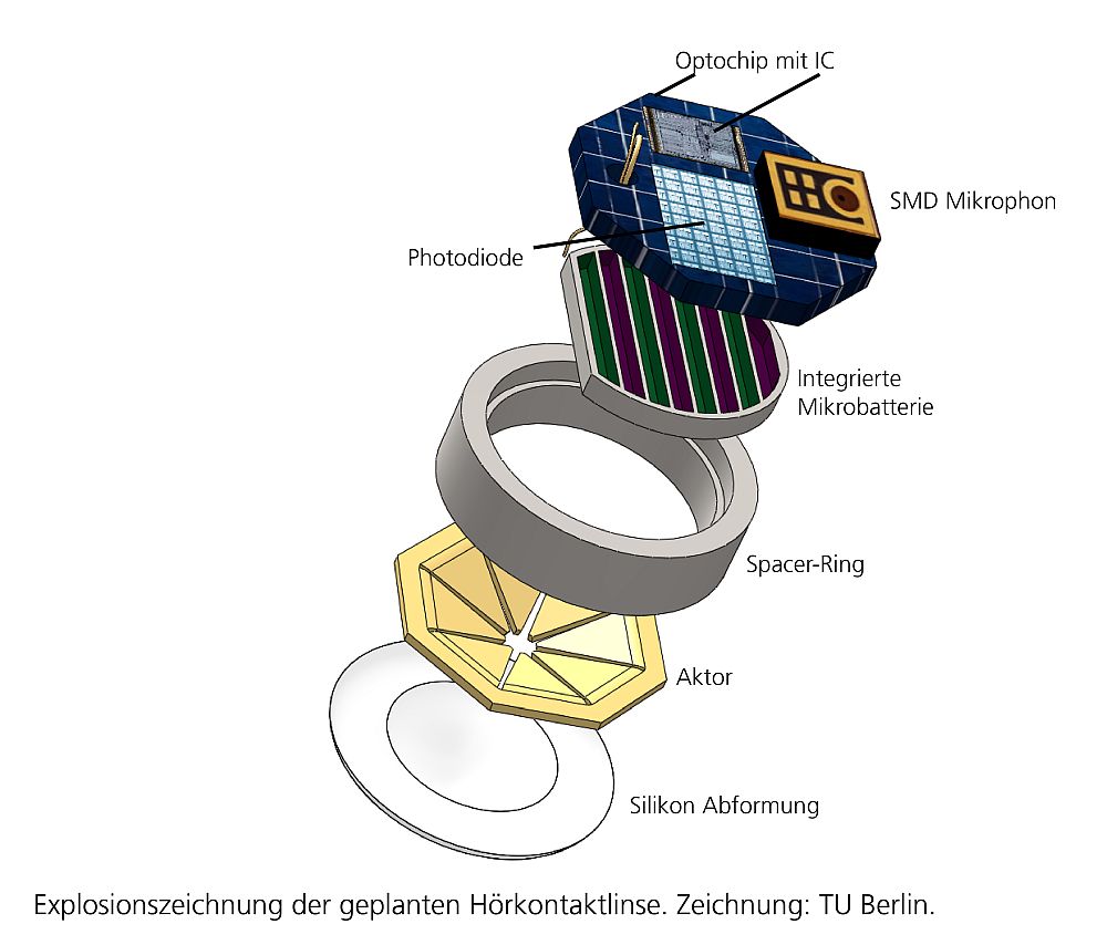 Explosionszeichnung - TU Berlin - Weltneuheit: Deutsche Forscher entwickeln Kontaktlinse für das Trommelfell